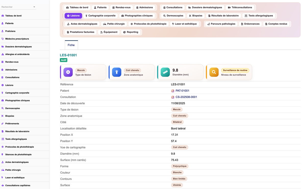 DoliResources - Dolibarr - 11_lesion_card