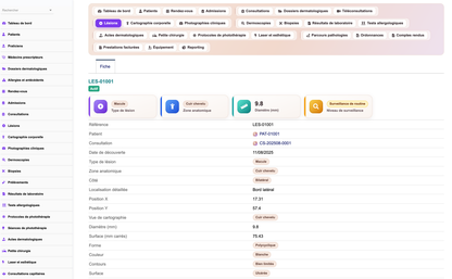 DoliResources - Dolibarr - 11_lesion_card