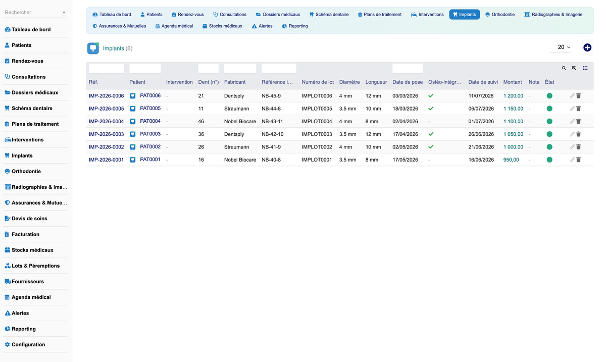 DoliResources - Dolibarr - 17_implants_list_a8d5e913-0113-4edf-9bd3-46ce8bf66bde